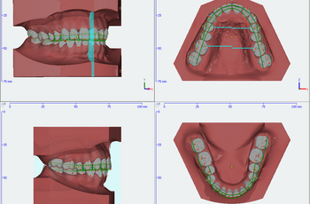 digitale Modellauswertung